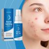 OUHOE Herbal Relief Spray For Facial Discomfort Herbal Essence Gently Moisturizes And Soothes Skin
